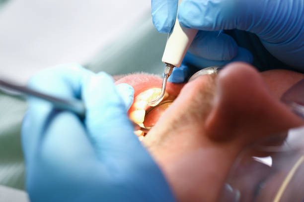 Best Cracked Tooth Emergency Dentist  in Burke Centre, VA