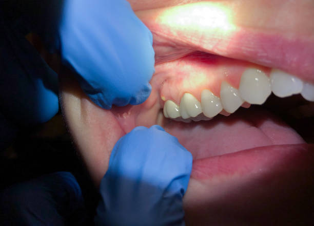 Best Walk-In Dentist Near Me  in Burke Centre, VA