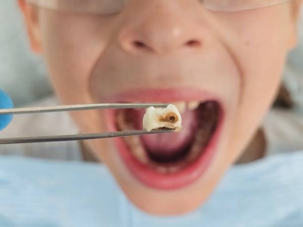 Best Emergency Dental Services Near Me  in Burke Centre, VA