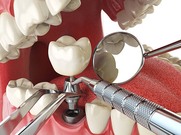 Best Cracked Tooth Emergency Dentist  in Burke Centre, VA